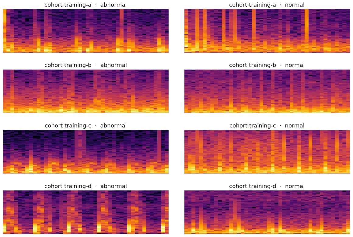 Heart sound spectrograms grouped by cohort
